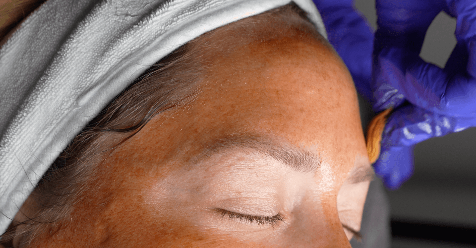 Womens Skin Health Assessment | Anti-Aging Skincare Evaluation | ENNU Life 17 Image link